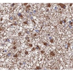 PKM1-specific Antibody