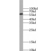 WB analysis of mouse skeletal muscle tissue, using PKM1 antibody (1/1000 dilution).