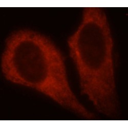 PKM2-specific Antibody