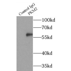 PKM2-specific Antibody