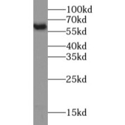 WB analysis of HeLa cells, using PKM2-specific antibody (1/1000 dilution).