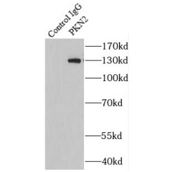 Serine-Threonine-Protein Kinase N2 (PKN2) Antibody