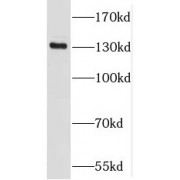 WB analysis of A2780 cells, using PKN2 antibody (1/500 dilution).