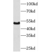 WB analysis of COLO 320 cells, using PKNOX1 antibody (1/300 dilution).