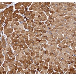 Phospholipase A2 Group IV E (PLA2G4E) Antibody