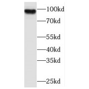 Western blot analysis of SH-SY5Y cells, using PLA2G4E antibody (1/1000 dilution).