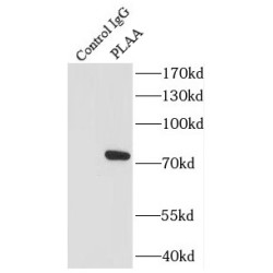 Phospholipase A2 Activating Protein (PLAA) Antibody