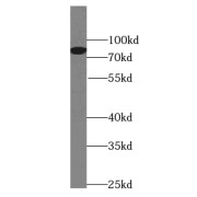 WB analysis of ROS1728 cells, using PLAA antibody (1/1000 dilution).