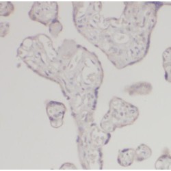 Placental Lactogen (CSH1) Antibody