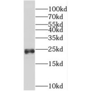 WB analysis of human placenta tissue, using CSH1 antibody (1/500 dilution).