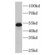 WB analysis of MCF-7 cells, using PLAGL1 antibody (1/600 dilution).