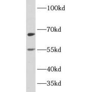 WB analysis of Raji cells, using PLAGL2 antibody (1/500 dilution).