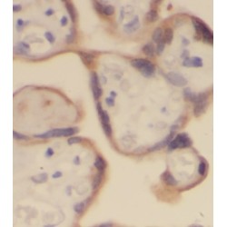 Alkaline Phosphatase, Placental Type (ALPP) Antibody