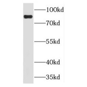 WB analysis of SH-SY5Y cells, using PLCD3 antibody (1/600 dilution).