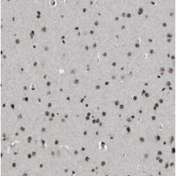 Pleckstrin Homology And FYVE Domain Containing 1 (PLEKHF1) Antibody