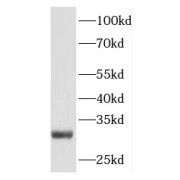 WB analysis of human skeletal muscle tissue, using PLEKHF1 antibody (1/500 dilution).