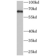 WB analysis of HeLa cells, using PLK1 antibody (1/1000 dilution).