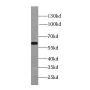 WB analysis of MCF7 cells, using PLK1-phospho (S326) antibody (1/200 dilution).