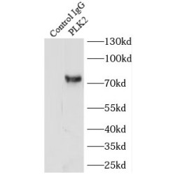 Polo Like Kinase 2 (PLK2) Antibody