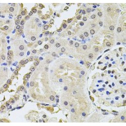 Serine/Threonine-Protein Kinase PLK4 (PLK4) Antibody