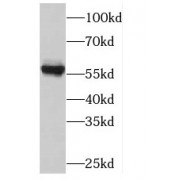 WB analysis of mouse testis tissue, using PLK5P antibody (1/300 dilution).