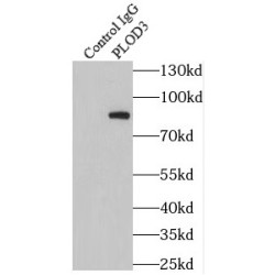 Procollagen Lysine-2-Oxoglutarate-5-Dioxygenase 3 (PLOD3) Antibody