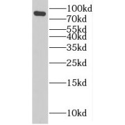 WB analysis of HepG2 cells, using PLOD3 antibody (1/800 dilution).