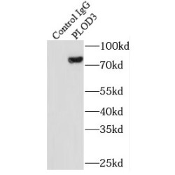 Procollagen Lysine-2-Oxoglutarate-5-Dioxygenase 3 (PLOD3) Antibody