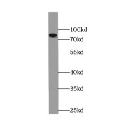 WB analysis of human placenta tissue, using PLOD3 antibody (1/300 dilution).