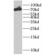 WB analysis of mouse small intestine tissue, using PLS1 antibody (1/1200 dilution).