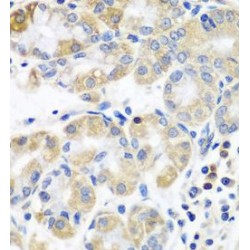 Plastin-3 (PLS3) Antibody