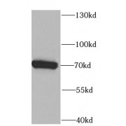 WB analysis of A431 cells, using PLS3 antibody (1/1000 dilution).