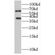 WB analysis of HepG2 cells, using PLS3 antibody (1/500 dilution).