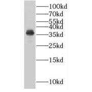 WB analysis of human heart tissue, using PLSCR4 antibody (1/400 dilution).