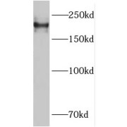 WB analysis of mouse brain tissue, using PLXNB1 antibody (1/300 dilution).