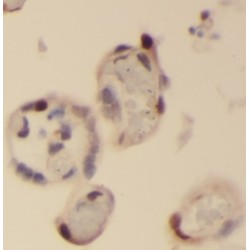 Peptidase M20 Domain Containing 2 (PM20D2) Antibody