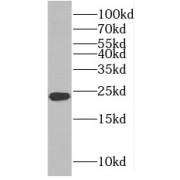 WB analysis of Jurkat cells, using PMF1 antibody (1/400 dilution).