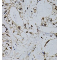 Promyelocytic Leukemia Protein (PML) Antibody