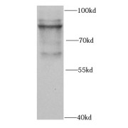 WB analysis of MCF7 cells, using PML antibody (1/1000 dilution).