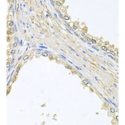 Phosphomannomutase 2 (PMM2) Antibody