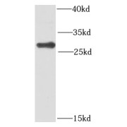 WB analysis of HepG2 cells, using PMM2 antibody (1/1000 dilution).