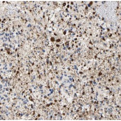 Paraneoplastic Antigen Ma1 Homolog (PNMA1) Antibody