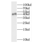 WB analysis of Jurkat cells, using PNMA2 antibody (1/2000 dilution).