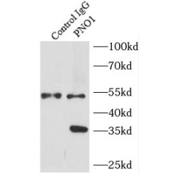 Partner of NOB1 Homolog (PNO1) Antibody