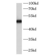 WB analysis of SKOV3 cells, using PNPLA3 antibody (1/1000 dilution).