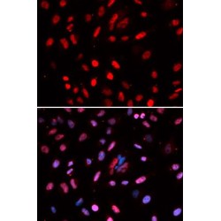 DNA Polymerase Delta 1, Catalytic Subunit (POLD1) Antibody