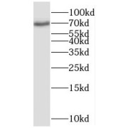 WB analysis of HeLa cells, using POLK antibody (1/500 dilution).