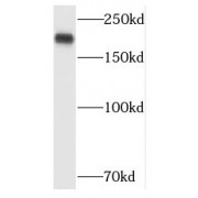 WB analysis of HeLa cells, using POLR1A antibody (1/1000 dilution).