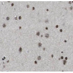 POLR2B-Specific Antibody