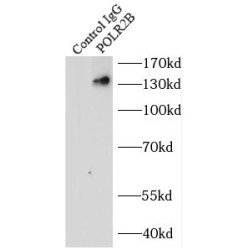 POLR2B-Specific Antibody